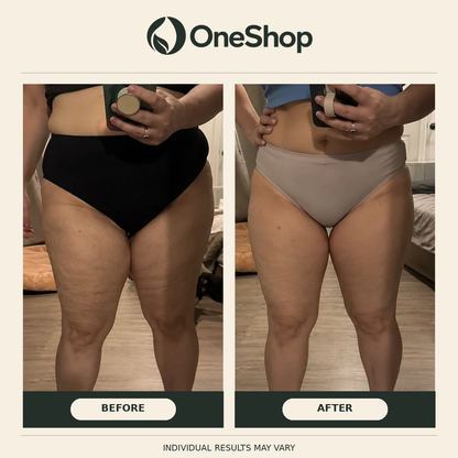 Huile Anti-Cellulite Naturelle
