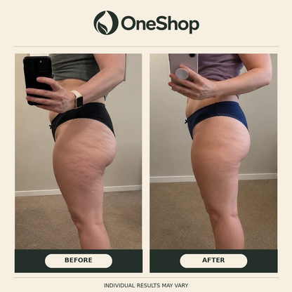 Huile Anti-Cellulite Naturelle